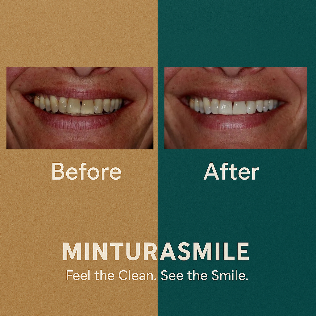 Remineralizing Chewing Gum